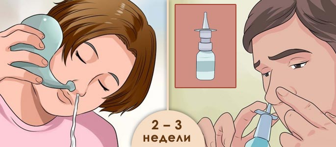 промывание носовых ходов
