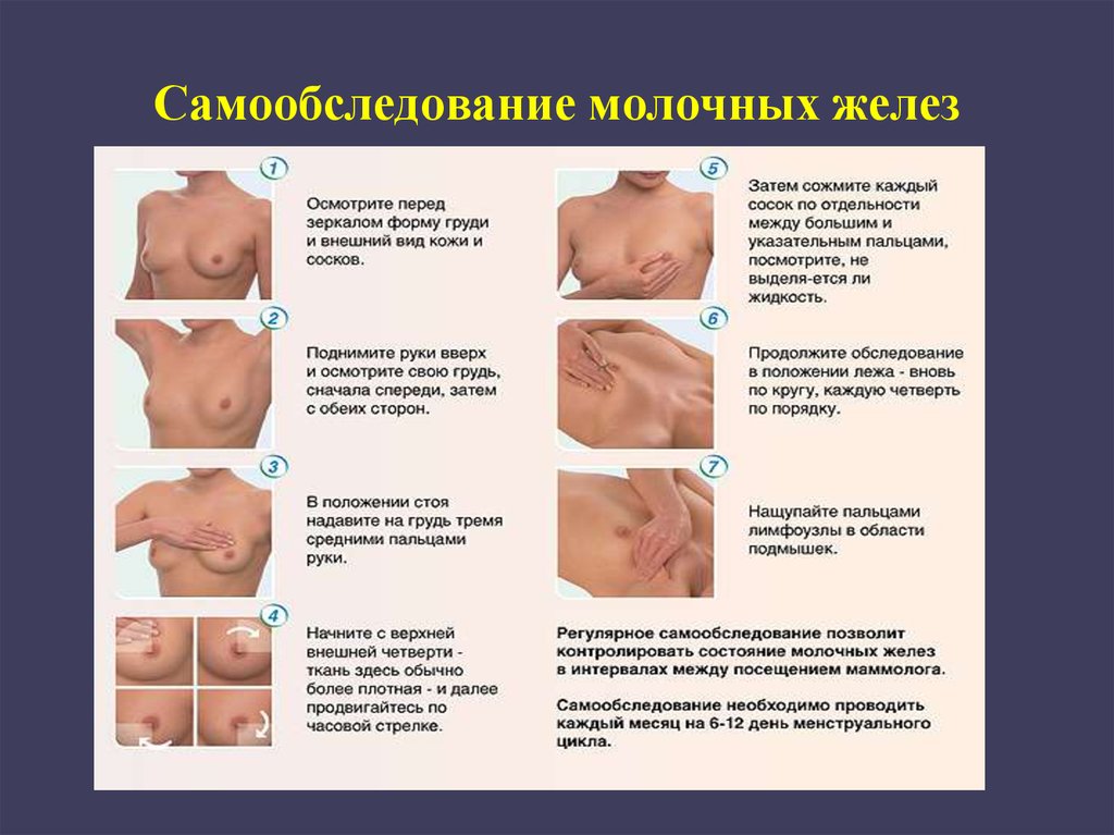 Самообследование молочных желёз