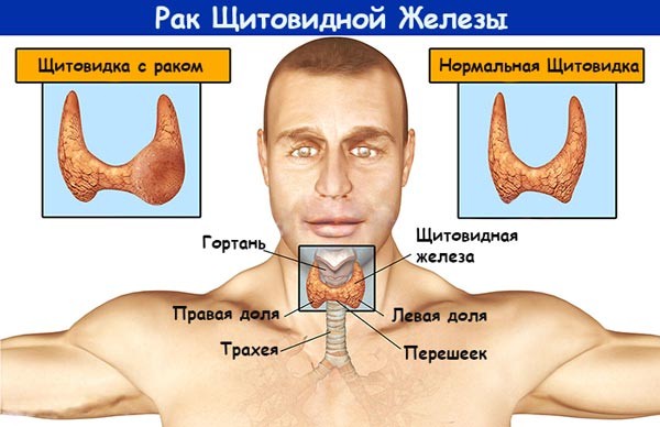 Щитовидная железа