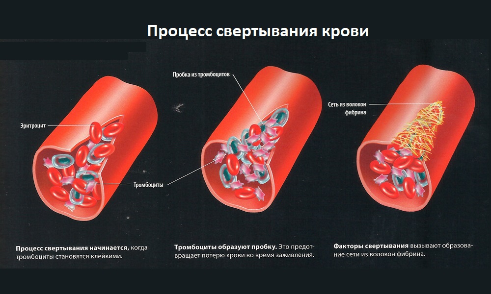 Схема процесса свертывания крови