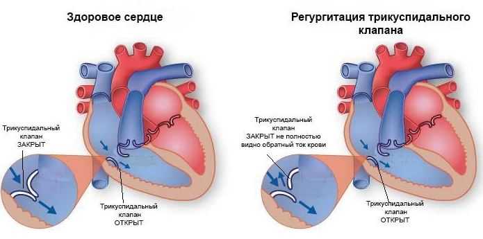 Схематическое отображение патологии