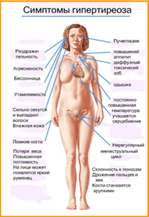 Симптомы гипертиреоза