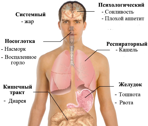 Симптомы свиного гриппа