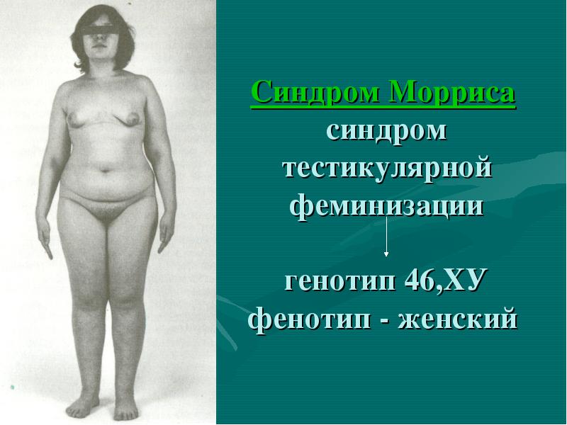 Синдром Морриса — генотип