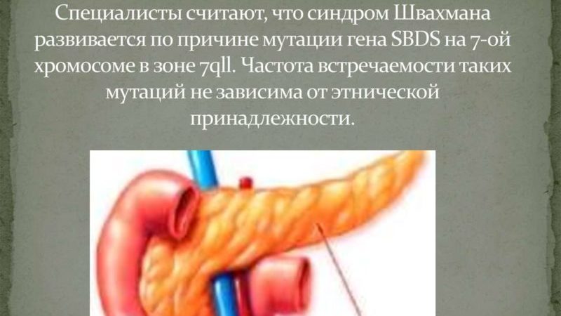 Что такое синдром Швахмана-Даймонда у детей и взрослых
