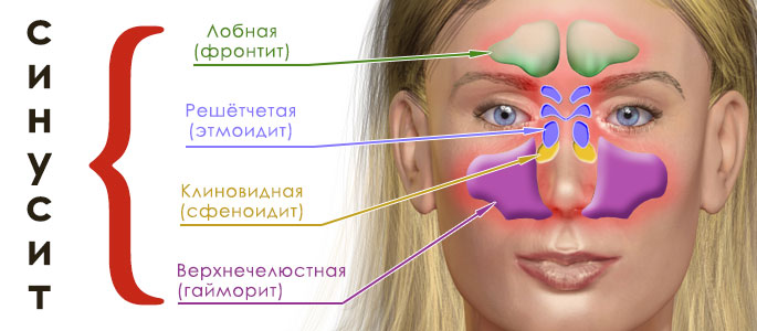 Схема расположения пазух