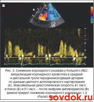 снижение коронарного резерва С