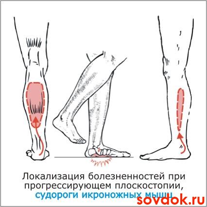 судороги икроножных мышц