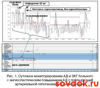 суточное мониторирование АД