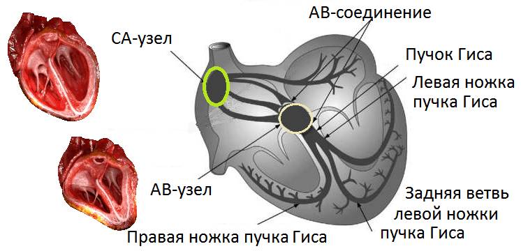 Тип ритмичных сокращений определяют по месту возникновения электрических импульсов