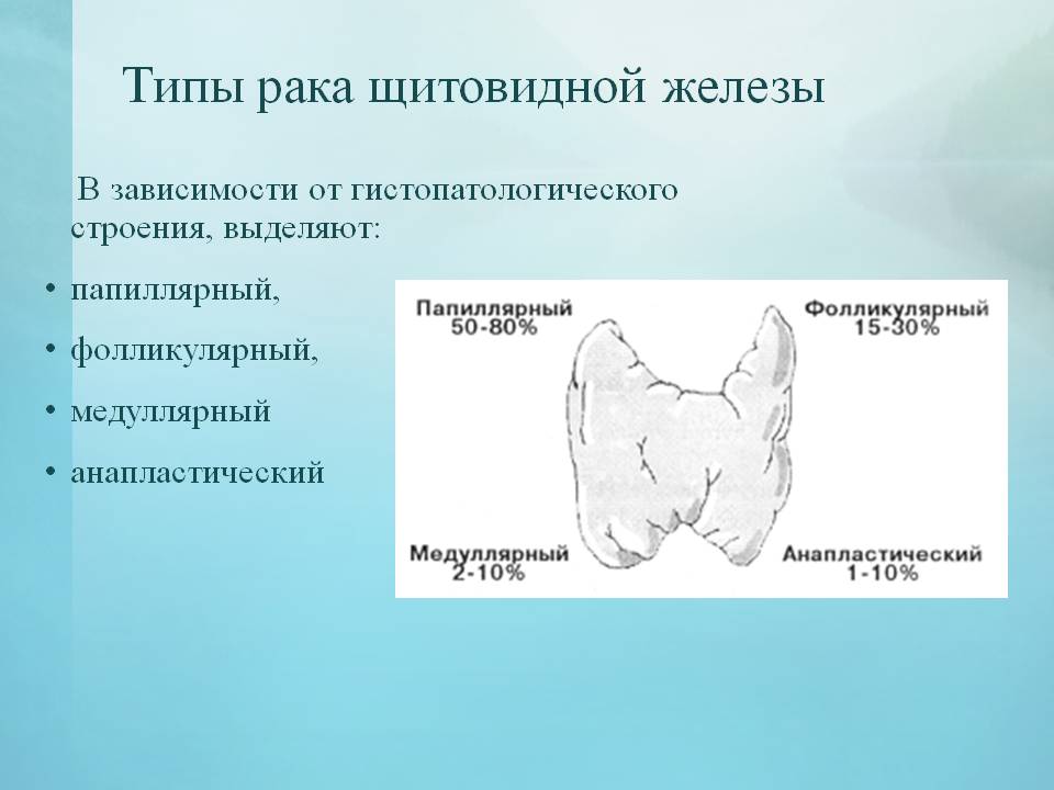 Типы рака щитовидной железы