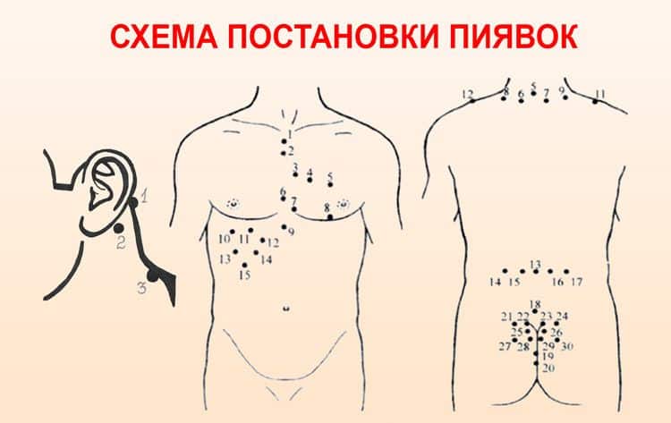Точки постановки пиявок на тело при высоком давлении