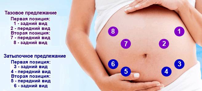Точки выслушивания громких сердечных тонов при различных положениях плода