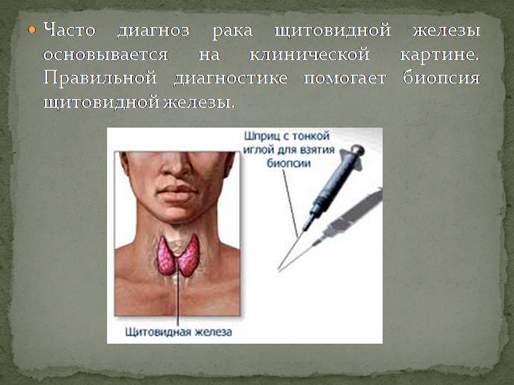 Тонкоигольная аспирационная биопсия