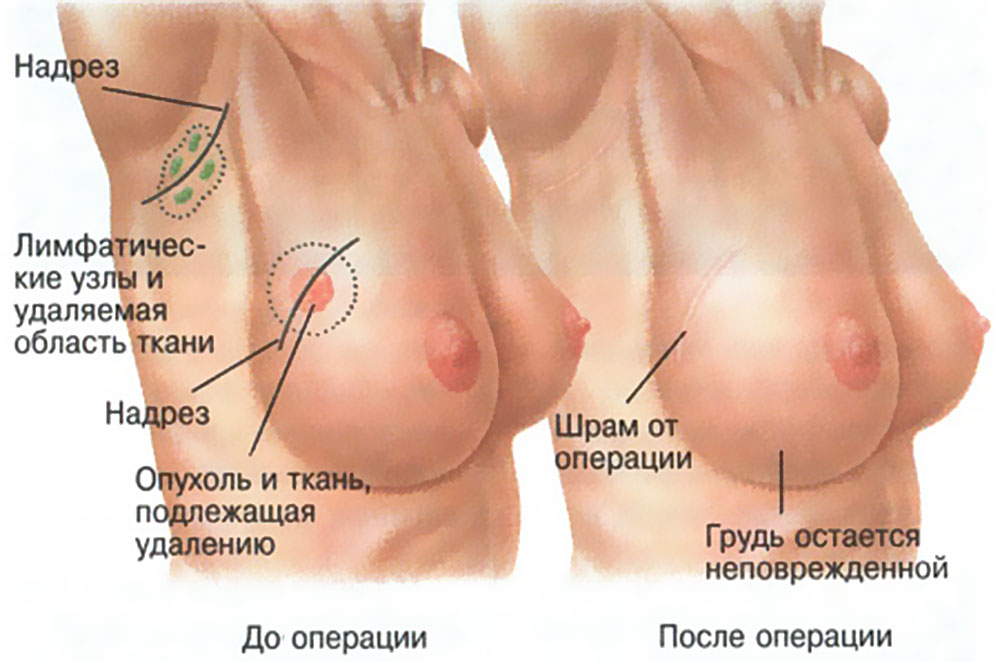 Фото до и после операции