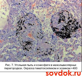 угольная пыль и кониофаги