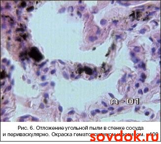 угольная пыль
