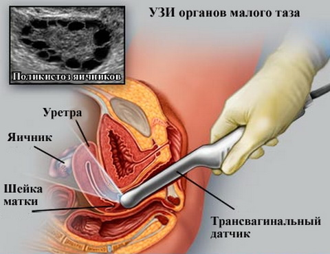 УЗИ