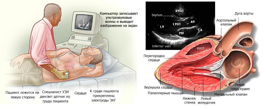 УЗИ
