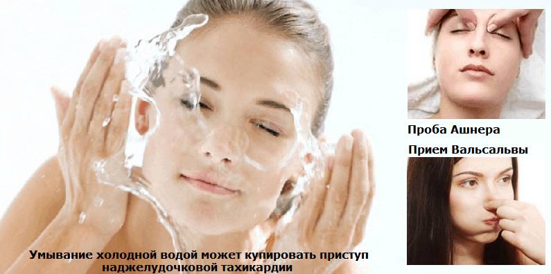 Вагусные пробы снижают ЧСС только при трепетании и мерцании предсердий, НЖ-тахикардии