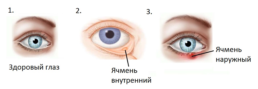 Виды ячменя
