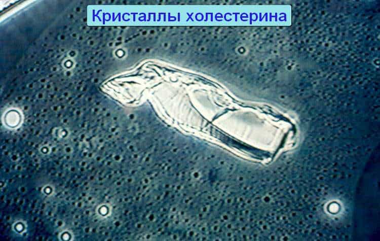 Включения