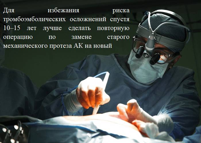Более 80 % прооперированных с ДАК живут в течение 10–15 лет без повторной операции и с максимально высоким качеством жизни