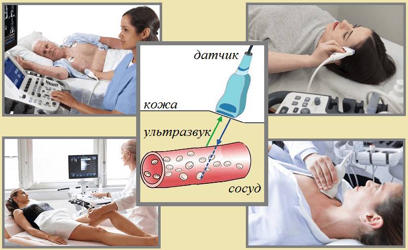 УЗ-допплер сосудов сердца, ног, головы и шеи