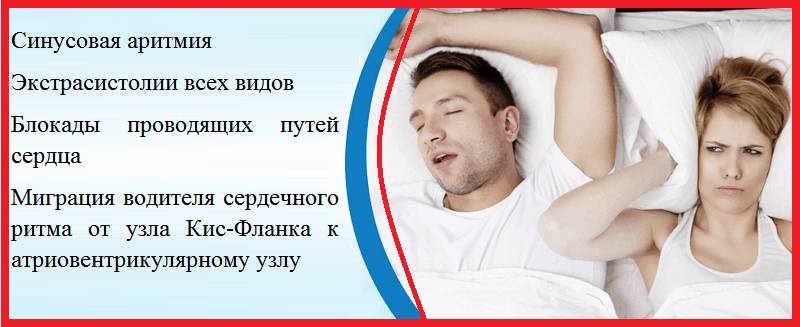 Основные типы нарушения сердечного ритма и проводимости при апноэ и храпе