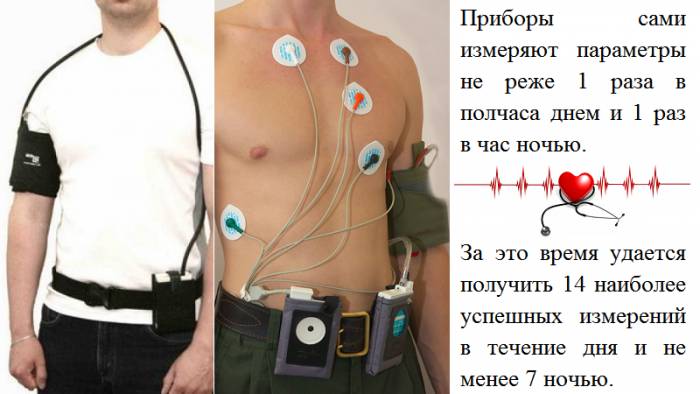 Длительность суточного мониторирования АД, ЧСС и ЭКГ – 25-28 часов