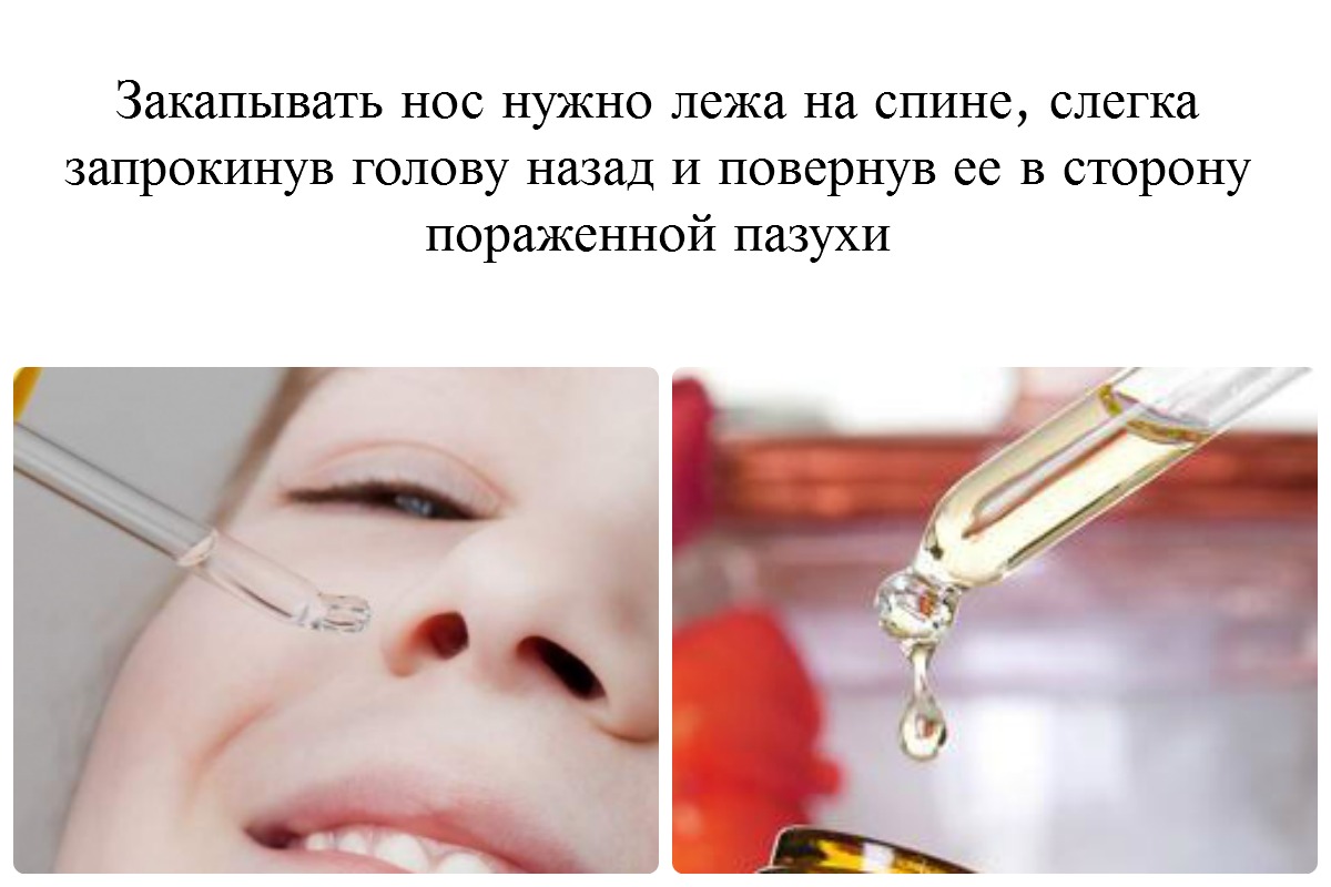 Закапывание носа при гайморите