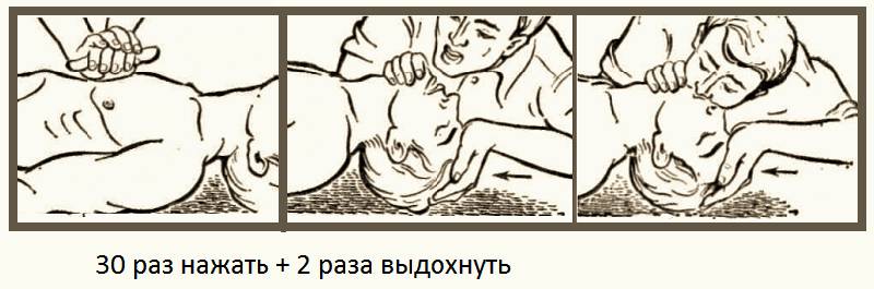 Золотое правило очерёдности и количество повторений манипуляций в одном цикле сердечно-лёгочной реанимации