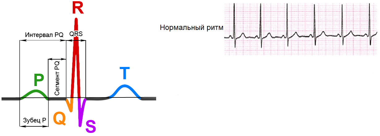 Комплекс PQRST и лента ЭКГ